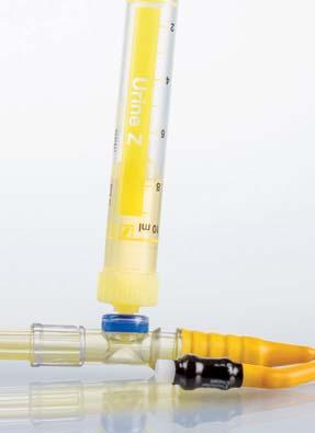 Obtenção de amostras sem o uso de agulhas A coleta de amostras sem o uso de agulhas, a partir de um sistema fechado de drenagem de urina, aumenta a