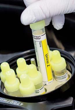 tiras As tiras para testes podem ser facilmente mergulhadas no Urina Monovette cheio de urina.