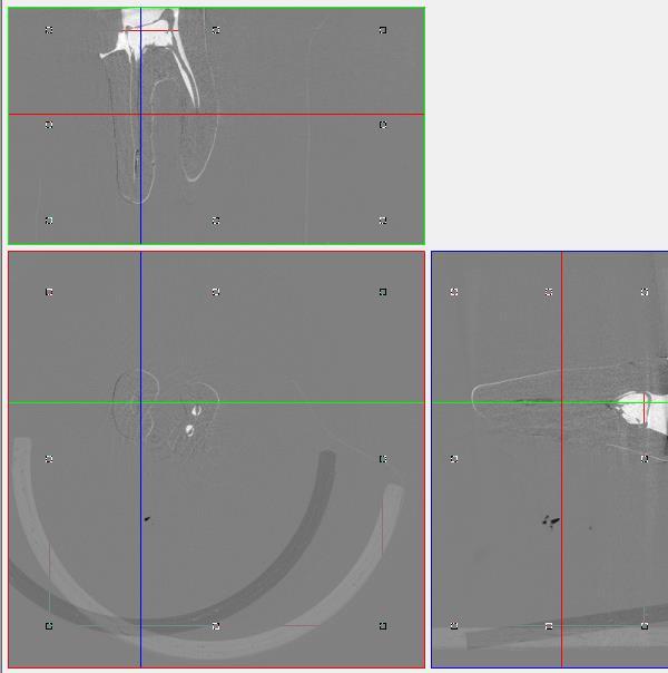 conjuntos de imagens, a fim de alinhá-los geometricamente na mesma posição espacial utilizando a função 3D registration (Figura 4.8).