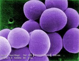 Parede celular dos procariotos Por que as bactérias precisam de uma