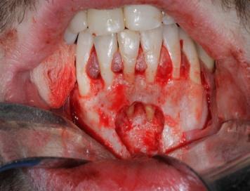 Endodontista.