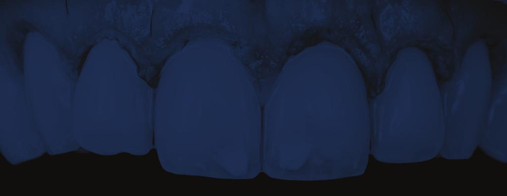 EM PERIODONTOLOGIA CLÍNICA Propinas 150 (cento e cinquenta euros) 7200,00 (Sete mil e duzentos euros) dentista: 200 (duzentos euros) Curso Pós-graduação (Diploma com ECTS): Propinas quando não