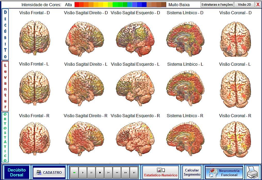 A análise do eixo vertical é importante para que possamos investigar e descobrir o que está acontecendo em regiões que insistem em prevalecer o mesmo comportamento neural, levando a prováveis