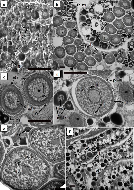 Figura 2 - Fotografias de secções histológicas de ovários de Mugil liza da Baía de Sepetiba em diferentes estádios de maturação.