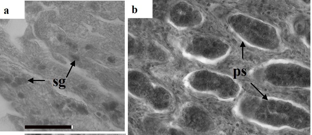 Figura 3. Fotografias de secções histológicas de testículos de Mugil liza da Baía de Sepetiba em diferentes estádios de maturação.