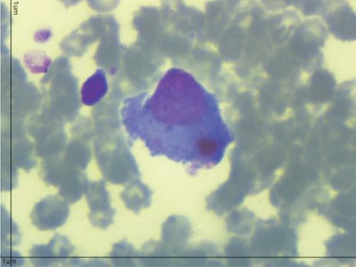 (Invitrogen ) a 1,5% corado com brometo de etídio por meio de um transiluminador de luz ultravioleta (2020E) acoplado a um programa computacional analisador de imagens (Eagle Eye II - Stratagene ).