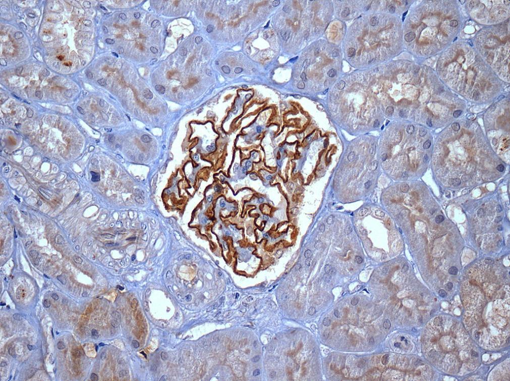 52 FIGURA 21- Glomérulo normal positivo para sinaptopodina