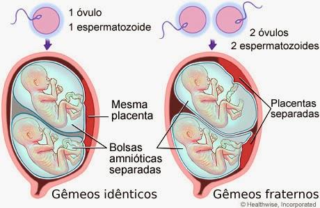 O pré-natal da gravidez múltipla deve começar precocemente com vigilância atenta à saúde materno fetal.com vistas à minimizar os transtornos inerentes dessa particular gestação.