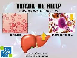 esquizocitos >5% (EL - Enzyme Liver): enzimas hepáticas TGO e TGP