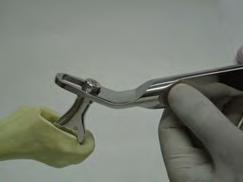 Extração da Haste Femoral Modular EUROMAXX Primária e Revisão Quando necessário a extração da prótese, utilize