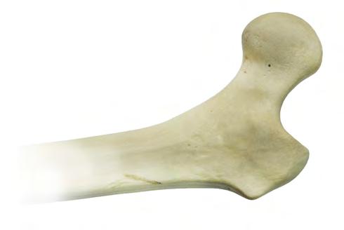 Para este tipo de prótese é indicado a posterior ou o anterolateral direta.