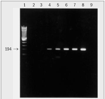 Toxoplasma gondii -Diagnóstico Molecular PCR- gene