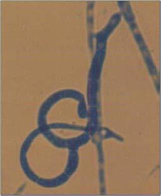 63 1000 X FIGURA 5: Fotomicrografia mostrando as armadilhas do tipo redes adesivas tridimensionais do fungo nematófago codificado CED, corado em azul de algodão.