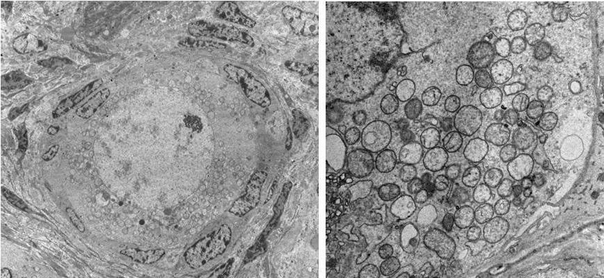 Detalhes das organelas são mostrados em (B) O: ovócito, CG: célula da granulosa, Nu: núcleo, L: gota de lipídio, m: mitocôndria, rel: retículo endoplasmático liso.