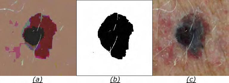 3.3 Merge (União) 58 Figura 3.14: (a) imagem após crescimento de regiões, (b) imagem binarizara com merge usando a média de intensidade dos cantos e (c) a imagem original.