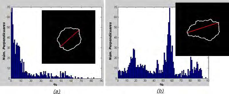 3.6 Caracterização das bordas 71 Figura 3.27: Exemplo de histogramas das diferenças das perpendiculares de uma lesão simétrica (a) e assimétrica (b).