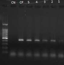 (Figura 2). Figura 2. Gel de agarose 1,5% com os resultados do teste de sensibilidade pela técnica de RT-PCR.