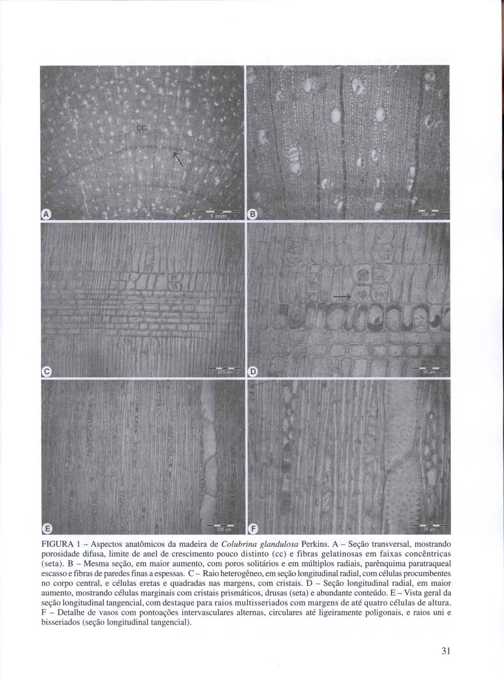 FIGURA I - Aspectos anatômicos da madeira de Colubrina glandulosa Perkins.