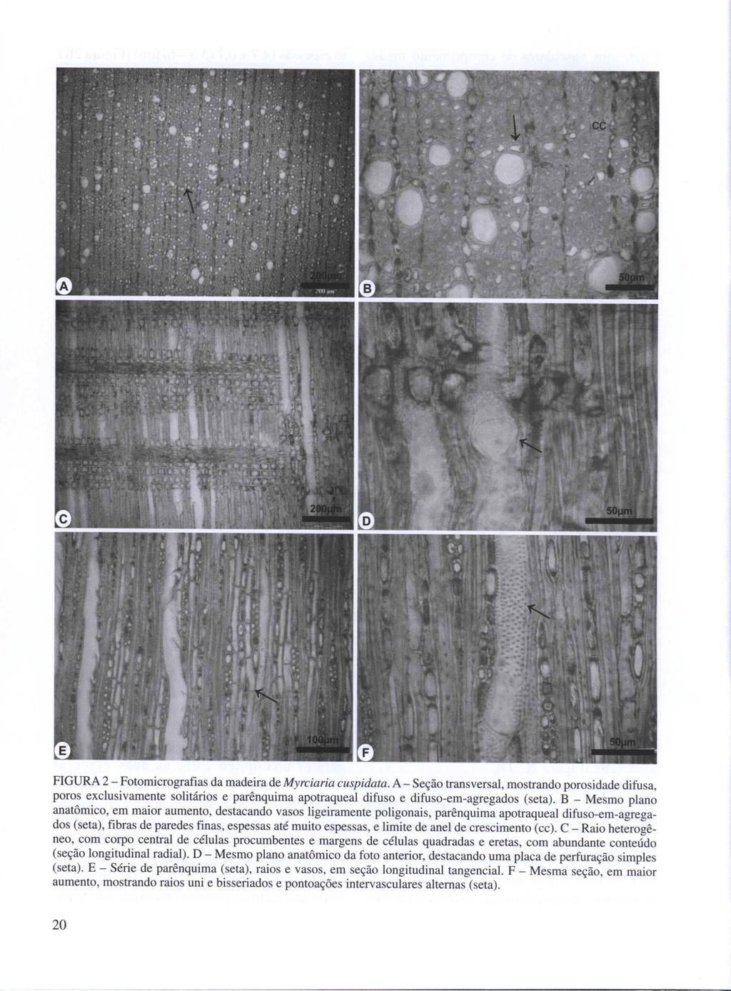 FIGURA 2 - Fotomicrografias da madeira de Myrciaria cuspidata.
