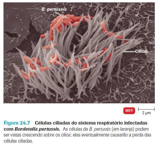 Bordetella pertussis As bactérias fixam-se às células ciliadas na