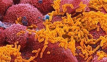 Haemophilus influenzae Fatores de Virulência Cápsula (6 sorotipos; a,b,c,d,e,f sorotipo b (Hib) é o mais virulento) propriedades antifagocíticas; maior tendência em causar infecções invasivas