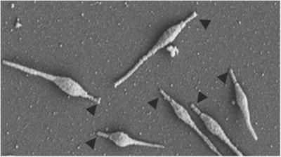 Mycoplasma pneumoniae Ausência de