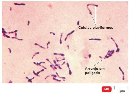 Corynebacterium diphtheriae Bacilo Gram-positivo, aeróbio Bem adaptado