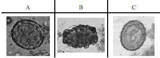 Tem cor castanha, são grandes e ovais, medindo 50 µm de diâmetros, são bem resistentes, devido à existência da membrana mamilonada.