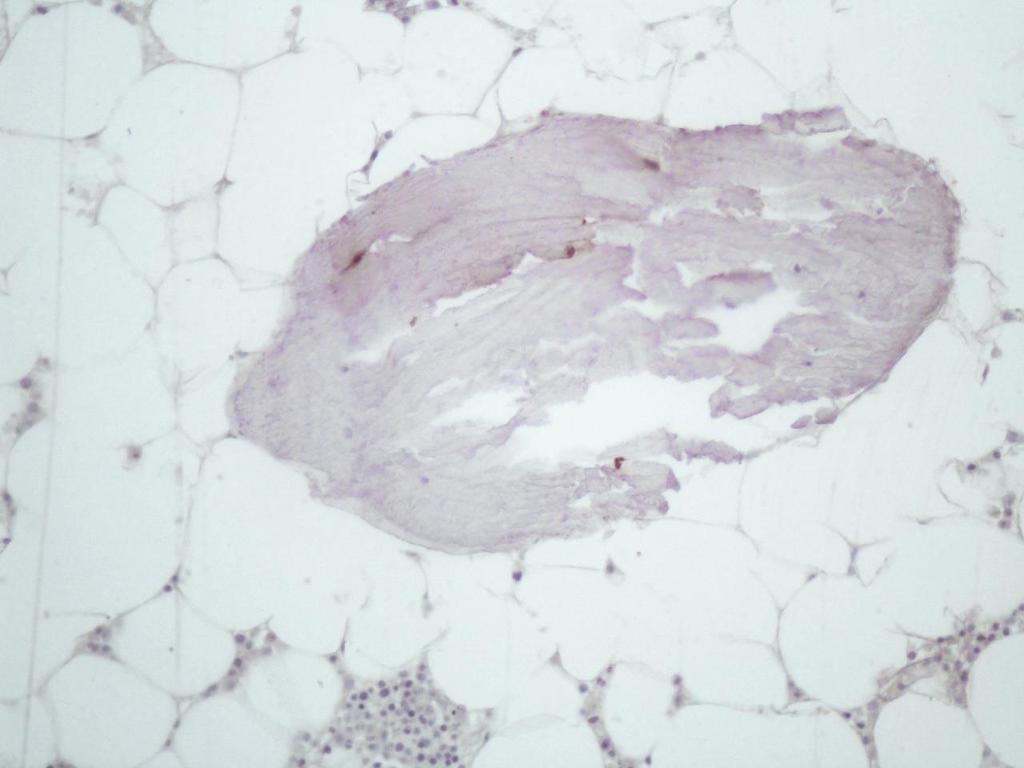 imunohistoquimica pré (A) e 1