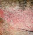 A DERMATITE ATÓPICA A dermatite atópica é uma doença cutânea inflamatória e pruriginosa, com sinais clínicos característicos.