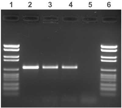 1) PCR