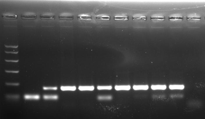 RESULTADOS Leish1/Leish2 Nested PCR PM Ls La La Lb Ls Lc La Lb Ls CN 120 pb PM S S P P P CP CP CP CP CN Após a nested-pcr: houve amplificação do DNA de La, Lb, Ls