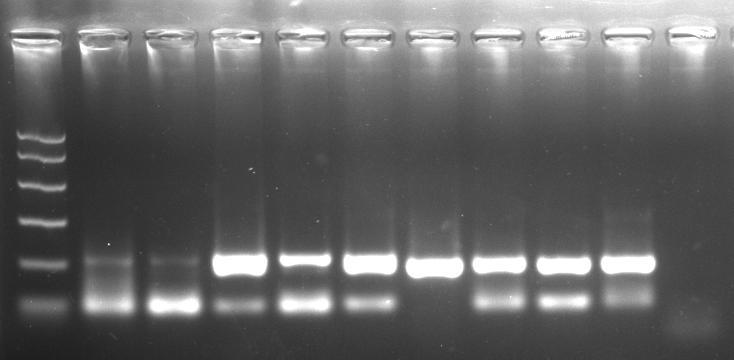 RESULTADOS RV1/RV2 Nested PCR PM La Ls La Lb Ls Lc La Lb Ls CN 145 pb PM S S P P P CP CP CP CP CN Houve detecção do DNA de La, Lb e Ls nas amostras anteriormente negativas Este par de primers tem