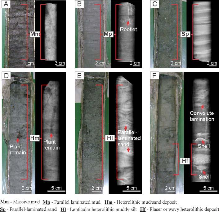 The core was X-rayed in order to identify internal sedimentary structures. As recorded in the figure 3, without the radiography of the core, would not be possible to evidence such structures.