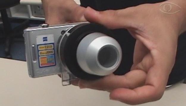 REALIZAÇÃO DE IMAGENS COM DERMATOSCÓPIO ATENÇÂO: é necessário aplicar o gel na lente do dermatoscópio! E dar o zoom máximo na câmera quando fotografar! 3.