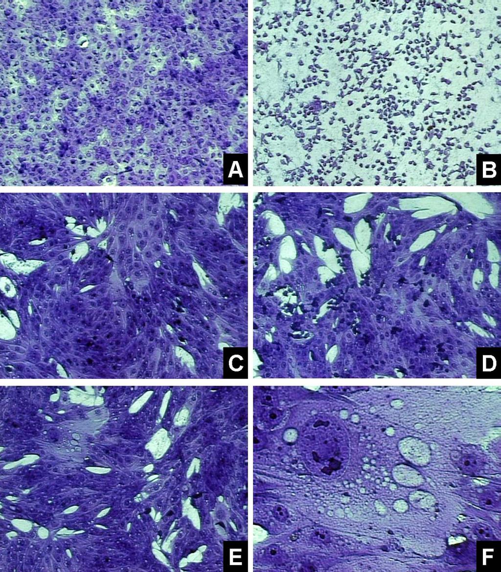 Figura 2.1: Efeito citopático observado na titulação viral em células MDBK a partir do pool de suabes nasais de coelhos infectados com o isolado Mutum de BoHV-5.