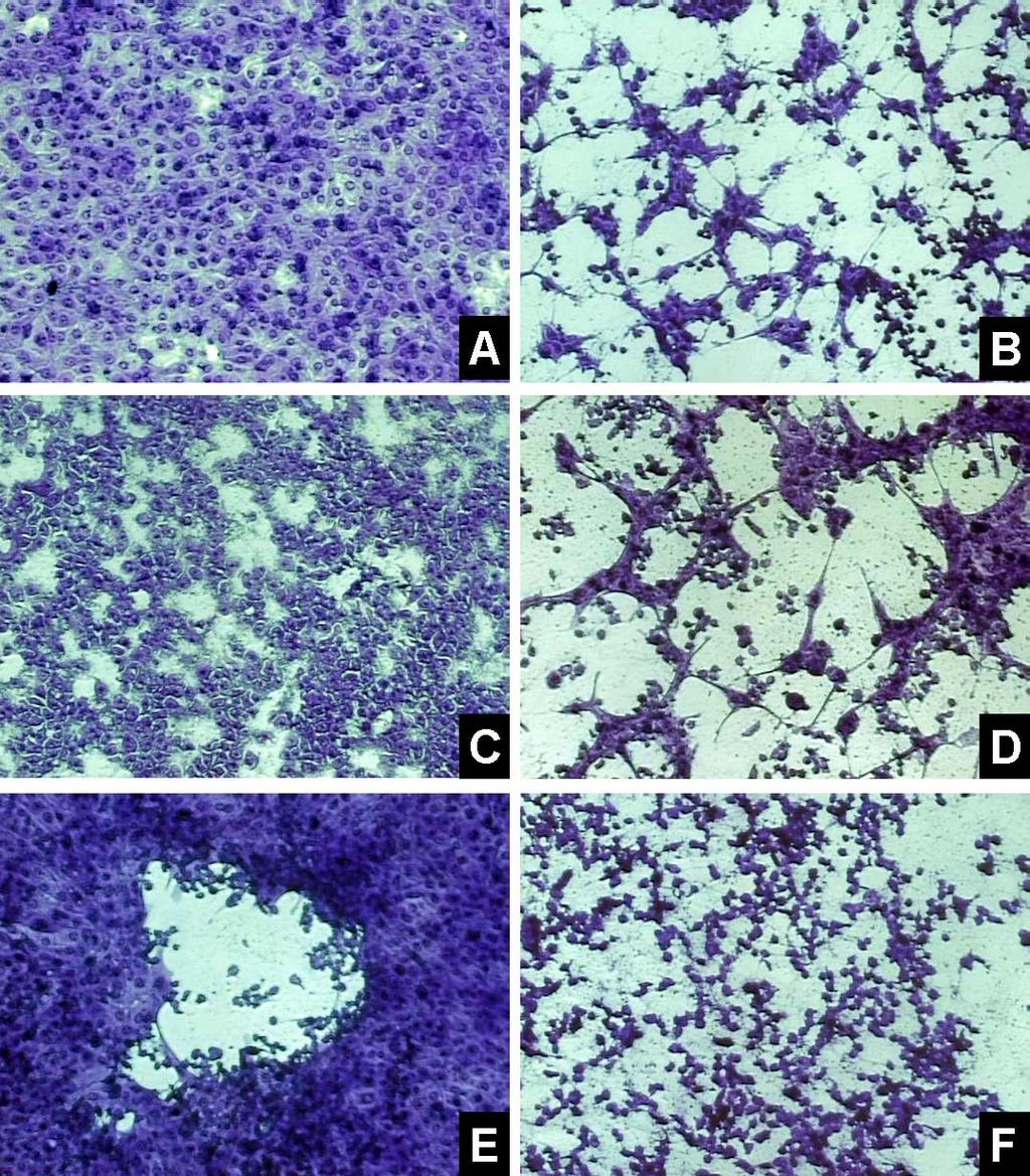 Figura 3: Efeito citopático observado na titulação viral em células MDBK a partir de diversos fragmentos de tecidos de coelhos infectados com o isolado Mutum de BoHV-5.