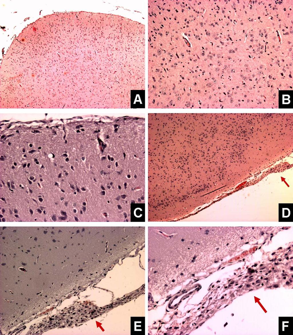 Figura 4.1: Cortes histológicos de sistema nervoso de coelhos experimentalmente infectados com a amostra Mutum de BoHV-5.