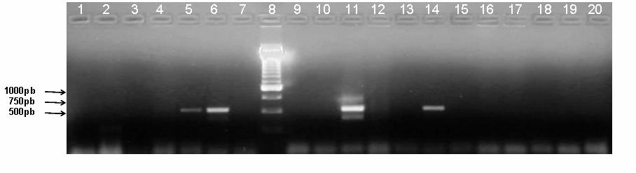 Figura 5: PCR semi-nested de DNA extraído do sobrenadante dos macerados de tecidos e suabes nasais 515pb. Gel de agarose 1,2 %, corado com brometo de etídio.