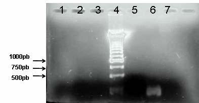 Figura 7: PCR semi-nested de DNA extraído do sobrenadante dos suabes nasais - 515 pb. Gel de agarose 1,2 %, corado com brometo de etídio.