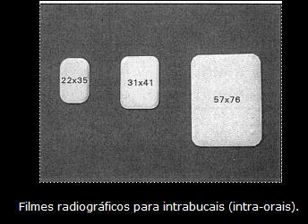 15 - Tamanho 31x41mm- Também denominado número 2, é geralmente utilizado para radiografia periapical e interproximal (bitewing) ; - Tamanho 57x76mm- Geralmente é utilizada para radiografia oclusal,