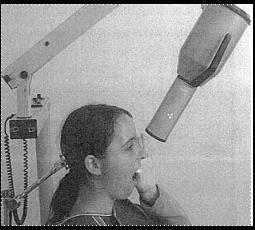 periapicais pela técnica de bissetriz na maxila (
