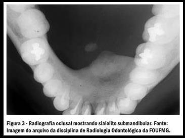 31 - Pesquisa de sialolitos nos condutos de Wharton ( glândulas salivares submandibulares) - Mensurações ortodônticas para determinação e controle da tração nos maxilares; - Estudo da fenda palatina;