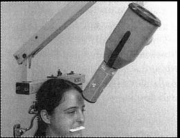32 Fig- 20.57a- Posicionamento do paciente para a incidência oclusal total de maxila. Fig.20.57b- Radiografia oclusal total de maxila.