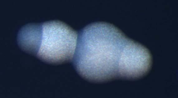 Estirpe do serótipo 5. A seta azul, branca e amarela indica uma colónia transparente, opaca e intermédia, respectivamente. Ampliação X25.