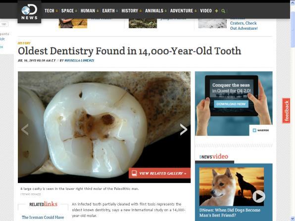 com/history/oldest-dentistry-found-in-14000-year-old-tooth-1507156.