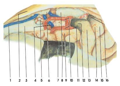 peça anatômica. Fig 4-B. Representação artística da fotografia anterior. 1. Veia occipital interna, 2. Foice, 3. Esplênio do corpo caloso, 4.