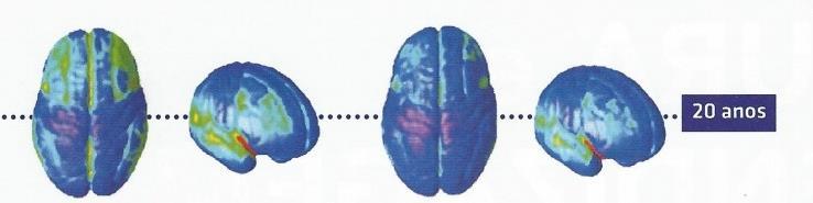 Transição do Cérebro Infantil ao Adulto Maturação Constante As primeiras regiões do cérebro a amadurecer são as sensoriais e