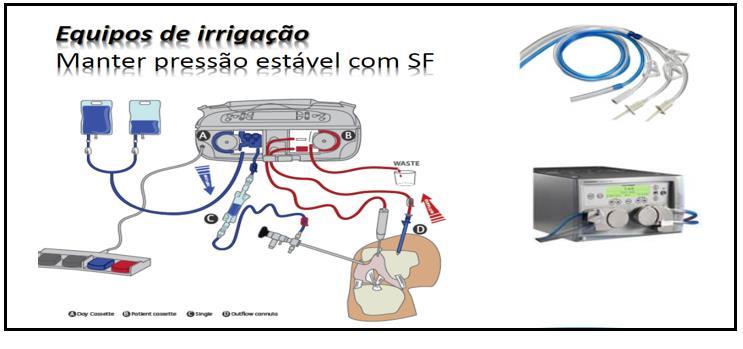 Na SAS esses equipos são tratados como material especial com solicitação de VPP SIM conforme nossa diretriz interna de