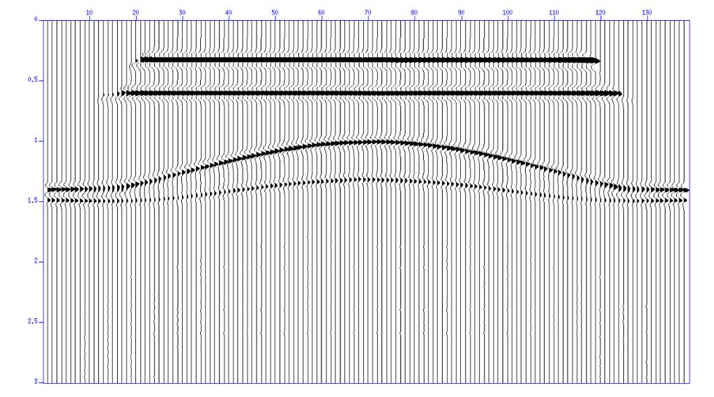 Figura 25: Modelo Multicamadas I empilhado no formato Wiggle
